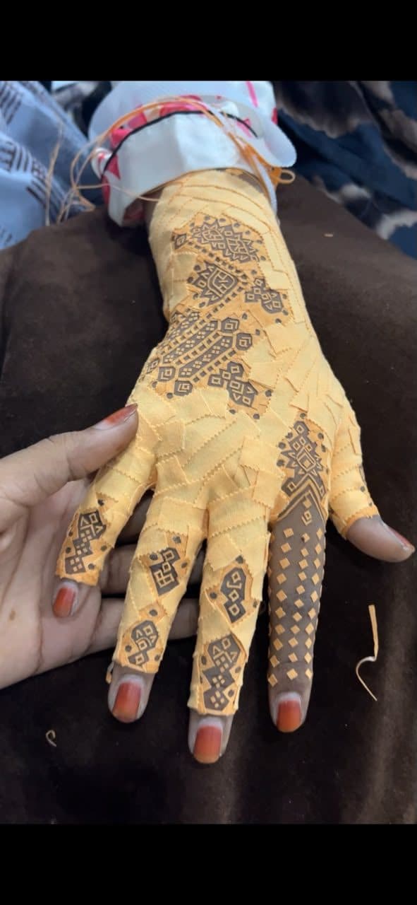 حنة من اسكوتش